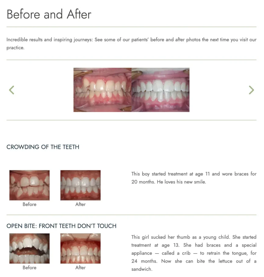 orthodontic-seo-before-after